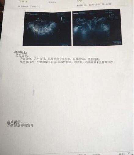 1466128115901386.jpg 790330744047203799.jpg