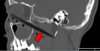 1469755439548655.jpeg 20160729084731_2636892bebbc370604013dff785851c6_1.jpeg