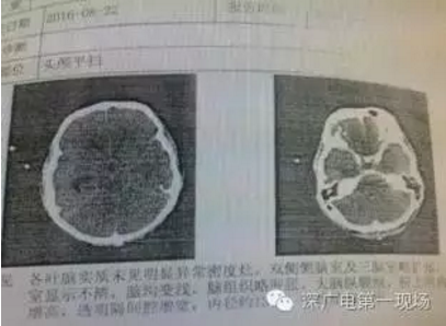 1476668655110002.png QQ截圖20161017094330.png